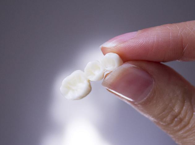 A closeup of a dental bridge held between two fingers