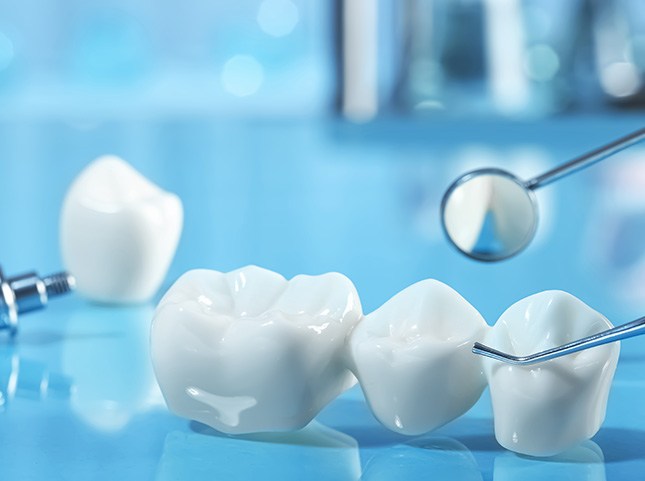 Dental implant next to dental bridge on reflective light blue surface