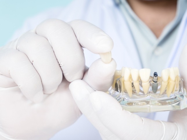 Dentist holding a dental crown and a dental implant model
