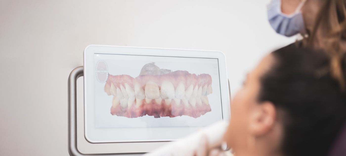Dental patient looking at digital models of teeth on computer monitor