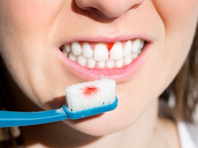 Close up of person with bleeding gums holding a bloody toothbrush