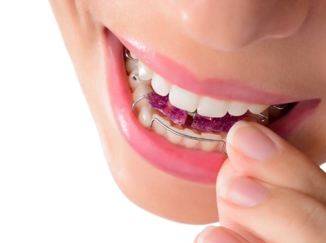 Close up of person placing retainer in their mouth