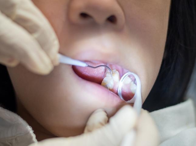 Pediatric dentist giving a child a dental exam