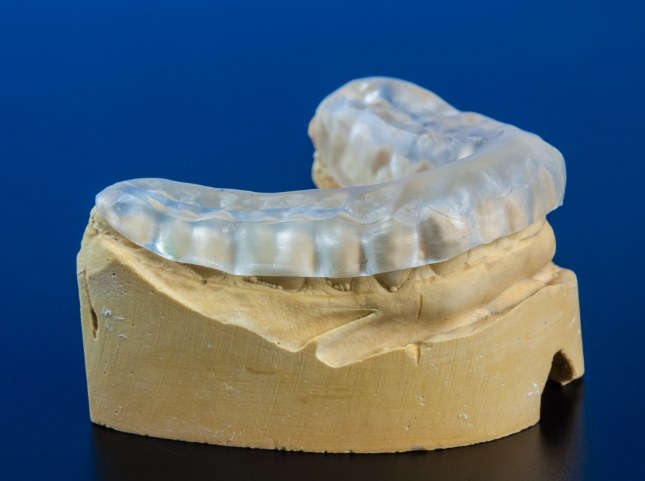 Clear nightguard over a model of the teeth