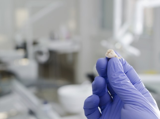 Dentist holding an extracted tooth in a gloved hand