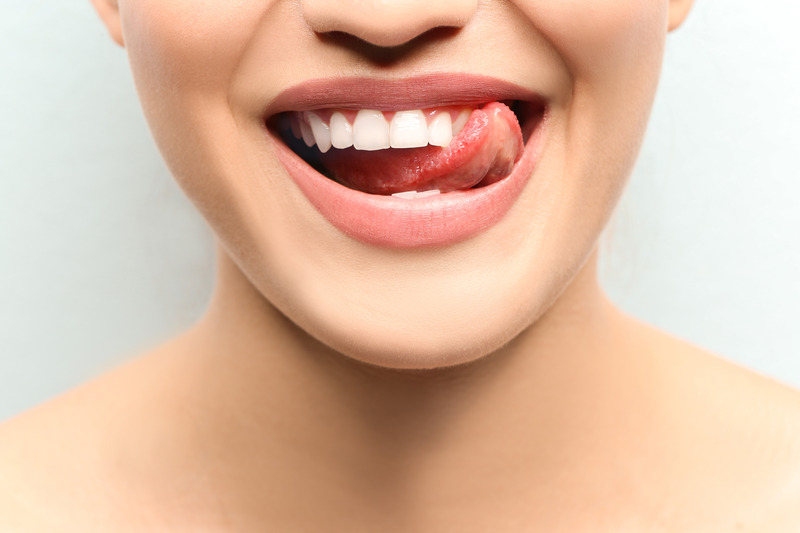 Patient smiling with their veneers